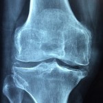 Medical Negligence Solicitors